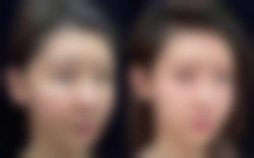 家长在宝宝眼皮发育过程中需要注意些什么呢？