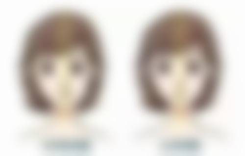 大腿小腿可以一起抽脂吗？揭秘双部位抽脂的安全性与效果！双部位抽脂后恢复快吗？