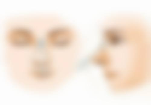 如何选择合适的医院和医生进行双部位抽脂手术？