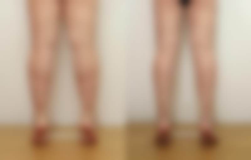 李敬秀医生手术的优势