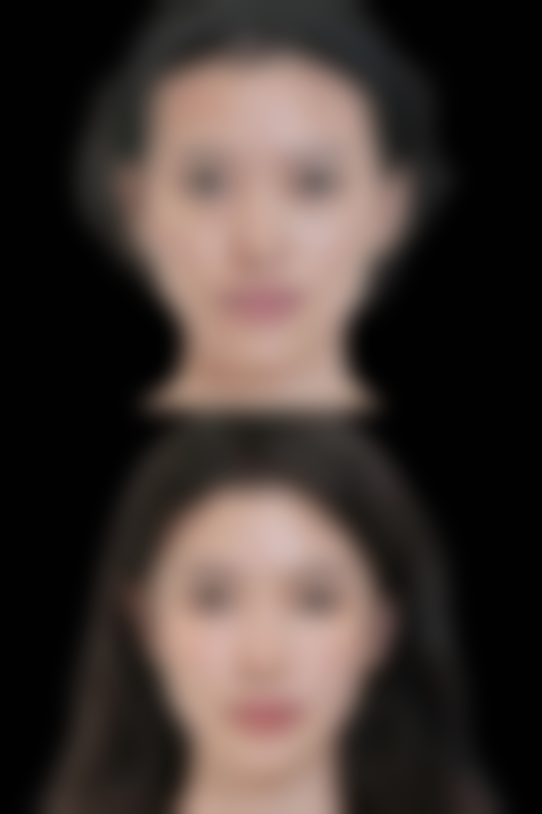 手术前需要注意什么？