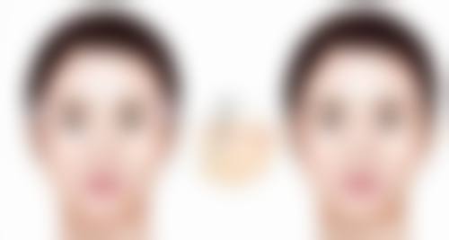 长痘留下的疤痕能去掉吗？揭秘有效的治疗方法与护理技巧！激光治疗和日常护理真有效吗？ 