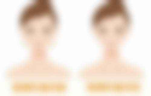 轻医美方向有哪些治疗方法呢?