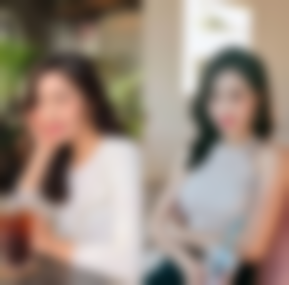 济南韩城整形美容医院刘同省医生韩式隆鼻技术怎么样?