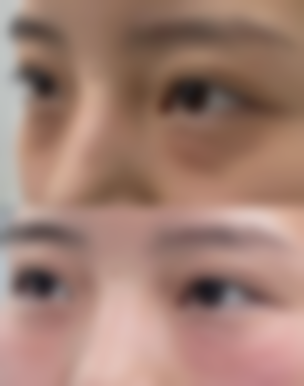 日常护理真的能起到作用吗?