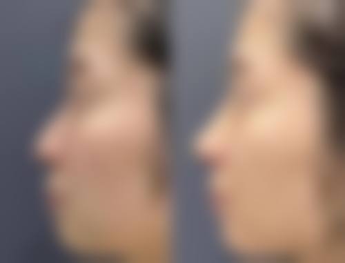 韩国明洞TATOA太朵皮肤科医院正规吗？