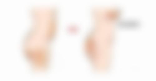 不同注射材料的除皱成效能维持多久？