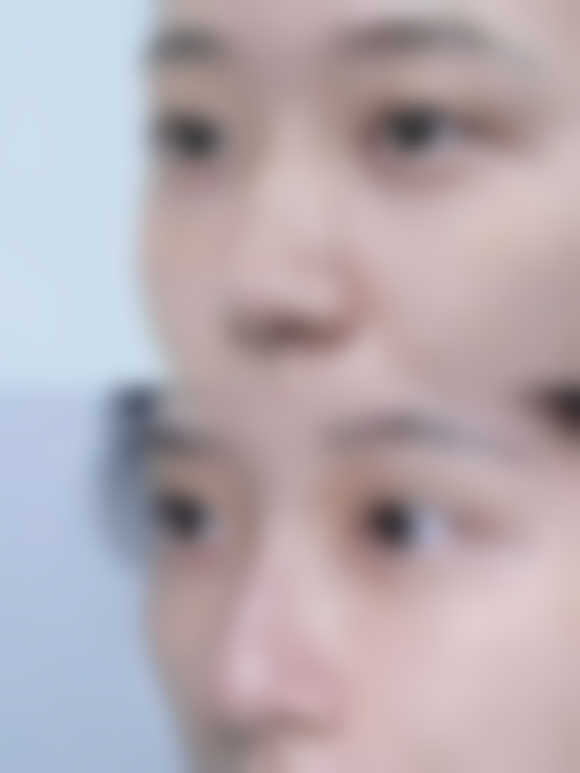 饮食上有什么需要注意的?