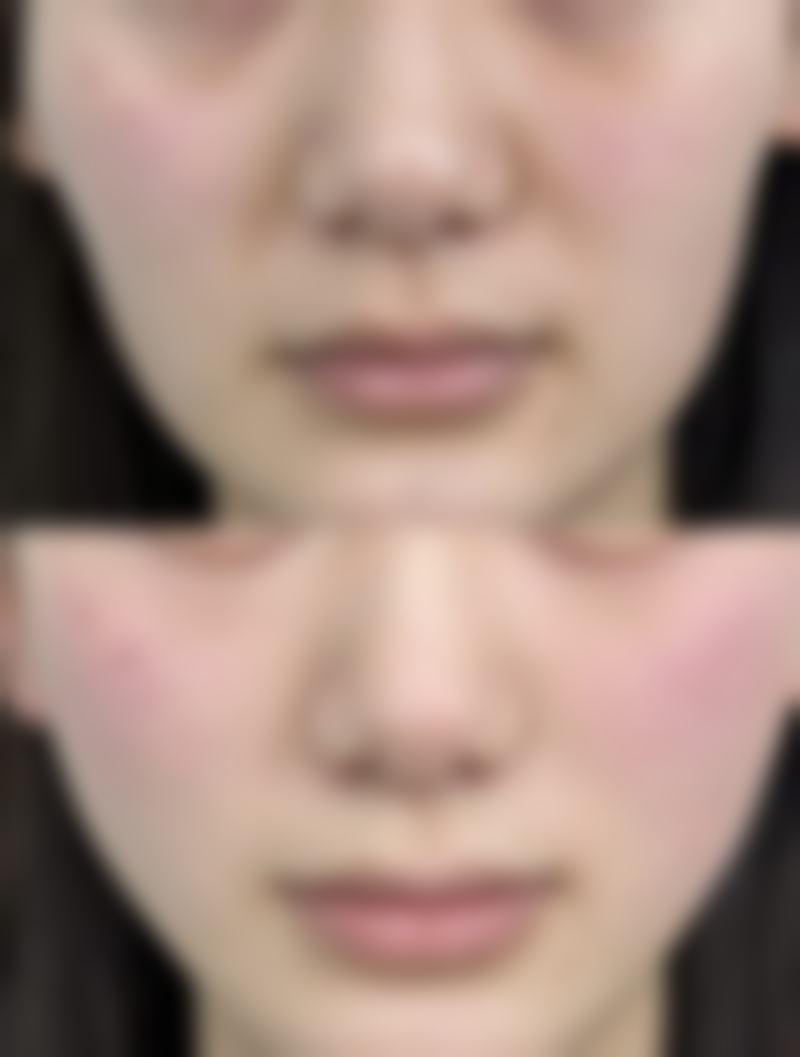 安顺市人民医院整形美容科口碑评价怎么样?