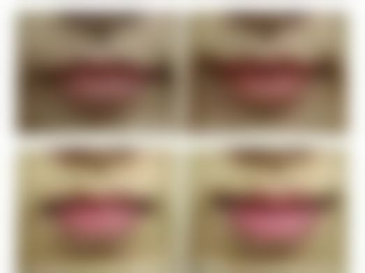 有哪些延长除皱针成效的方法？