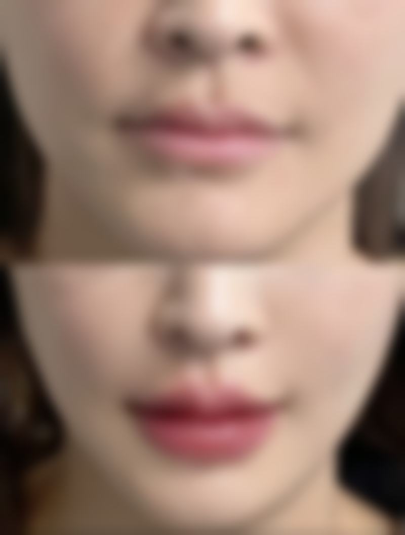 保定市竞秀区蓝山医疗美容医院正规吗?