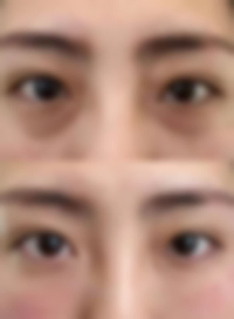 伤口护理有哪些要点?