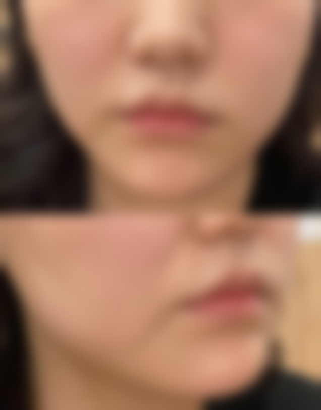 重庆医科大学附属第一医院整形美容科口碑评价怎么样？