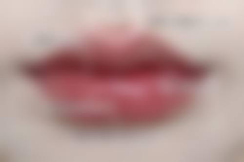 药物治疗能修复外翻吗，都有哪些药物呢？