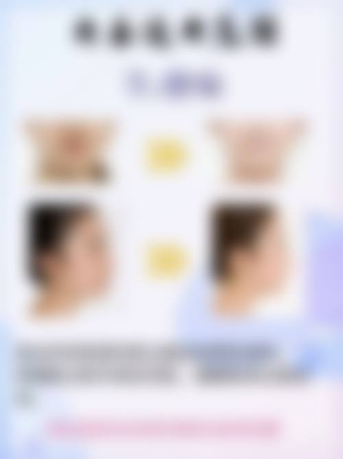 护理技巧有哪些？