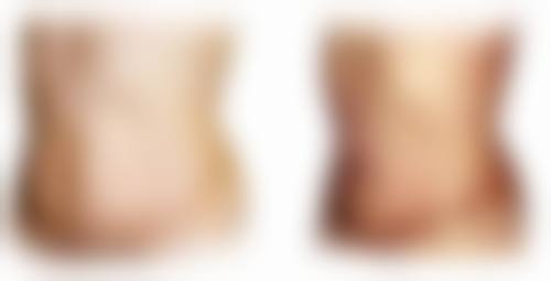 冷热敷该怎么选择呢？