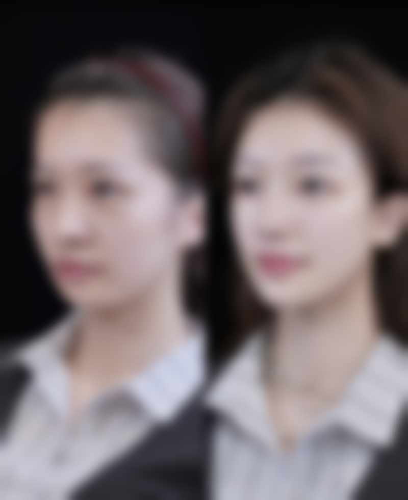 韩国乐于丽颜lovely yan整形外科口碑评价怎么样？