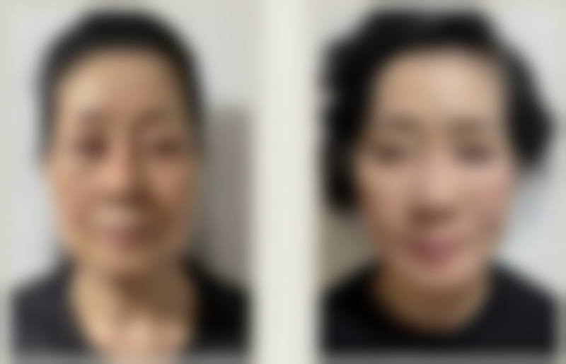 湘南美容 筑波院口碑评价怎么样？