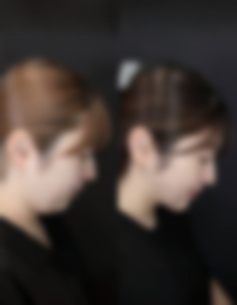 埋线双眼皮能恢复原样吗？揭秘手术后的真实效果与护理技巧！恢复时间和影响因素有哪些？ 