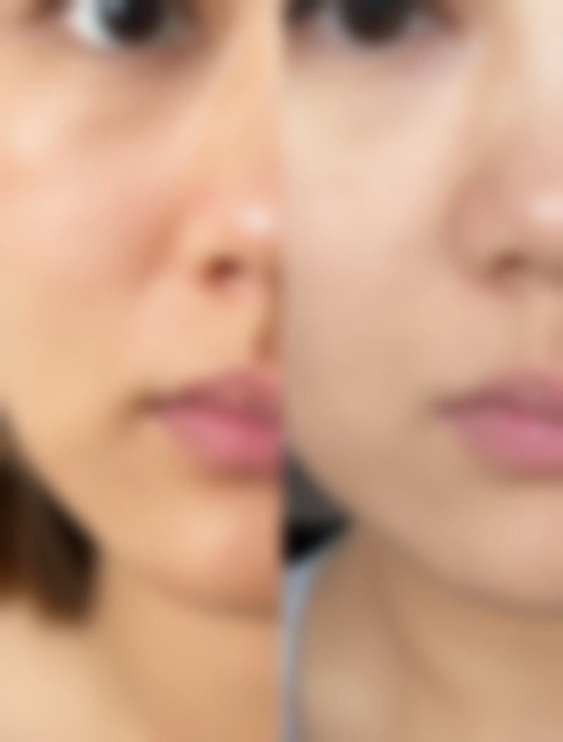 冰敷的正确使用方式是怎样的？