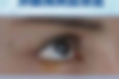 不同手术方式的风险有区别吗？