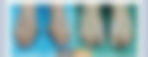 葫芦岛市华美希华医疗美容口碑评价怎么样？