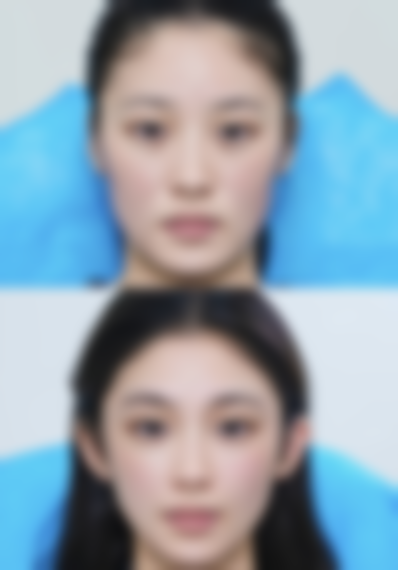 葫芦岛市华美希华医疗美容正规吗？