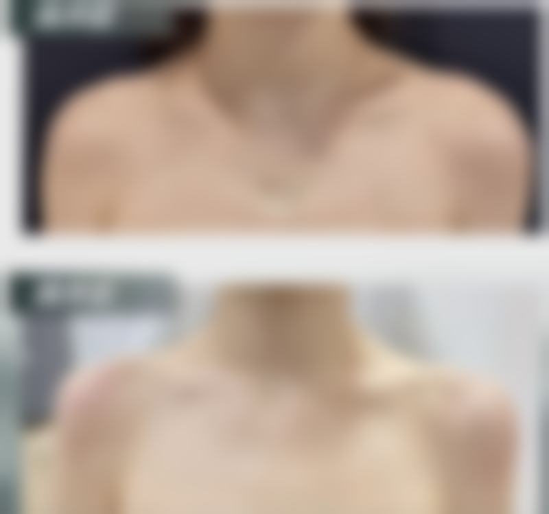 海口慢拾光医疗美容诊所庄姮医生擅长项目