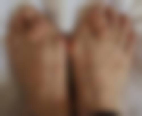 双眼皮手术有哪些类型，安心性如何？