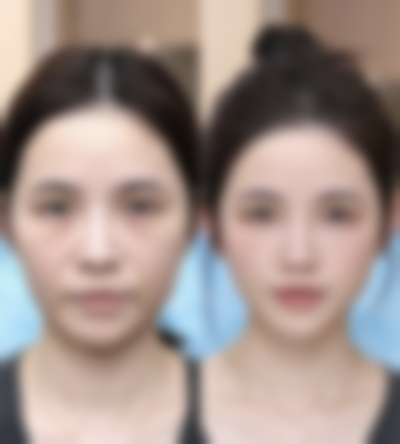 宁夏银川华美整形医院口碑评价怎么样？