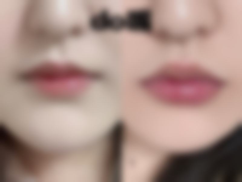 南通市第一人民医院（烧伤整形科）怎么预约