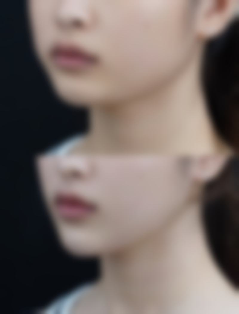 济宁壹美天成美容整形医院正规吗？