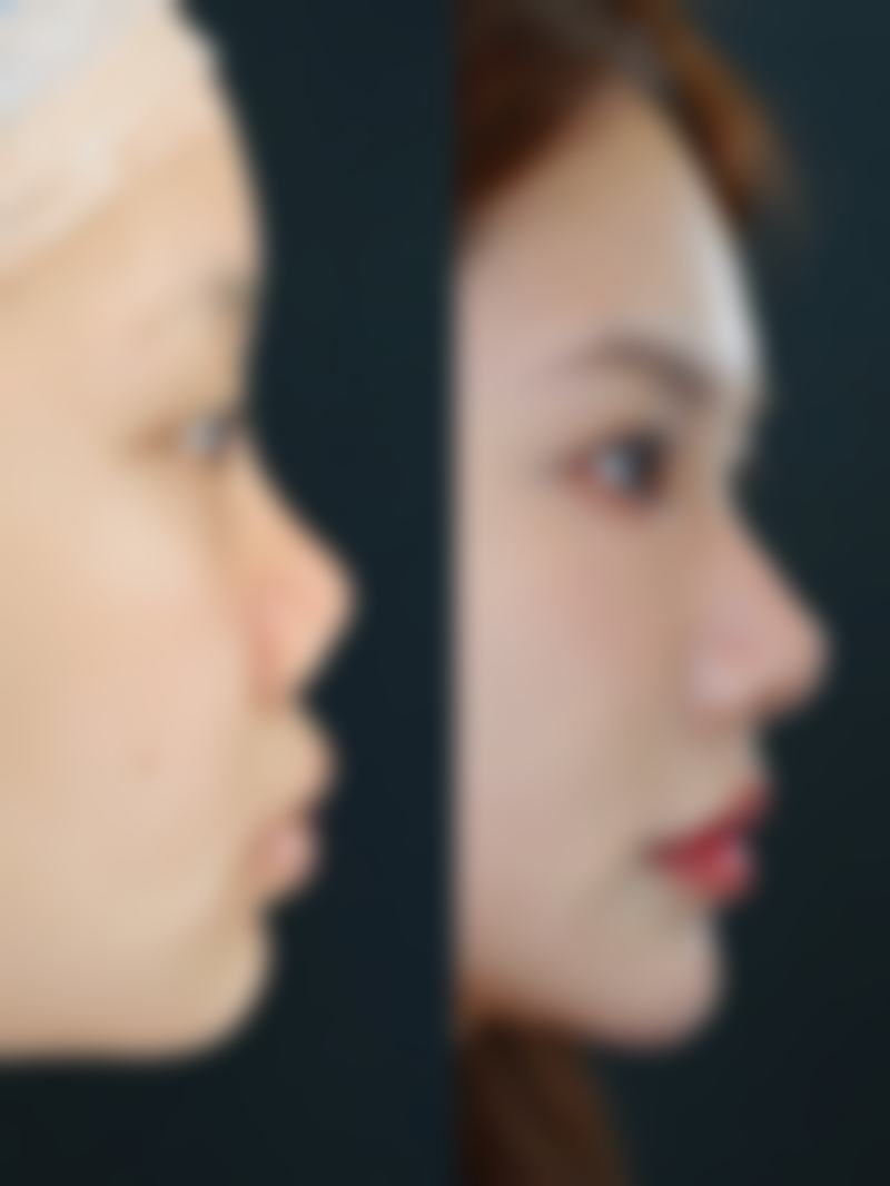 成都朗睿医疗美容诊所尹丹医生预约挂号指南