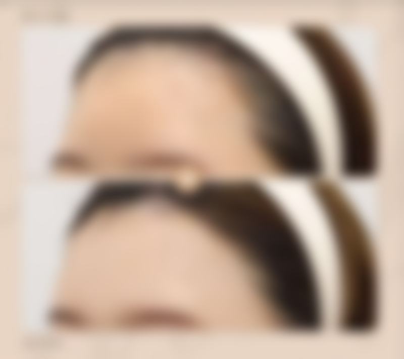 关键点四：术后其他护理细节不能忘！