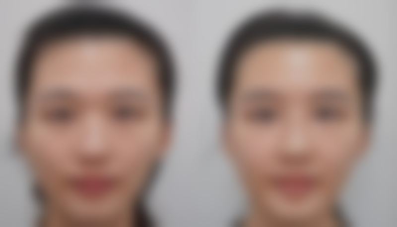 北京瑞丽天承整形医院正规吗？