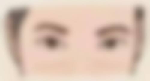 哪个双眼皮是永久的？揭秘持久美丽的选择与注意事项！埋线和全切双眼皮各有啥优势？ 