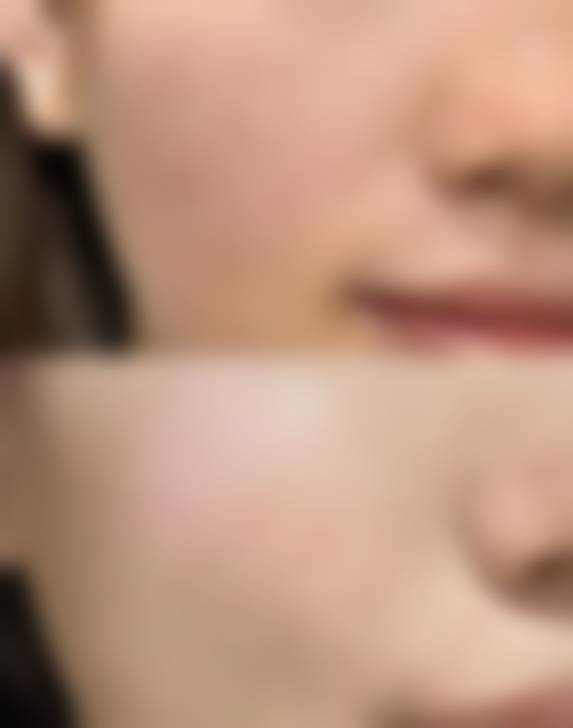 韩国Nine整形外科医院口碑评价怎么样？