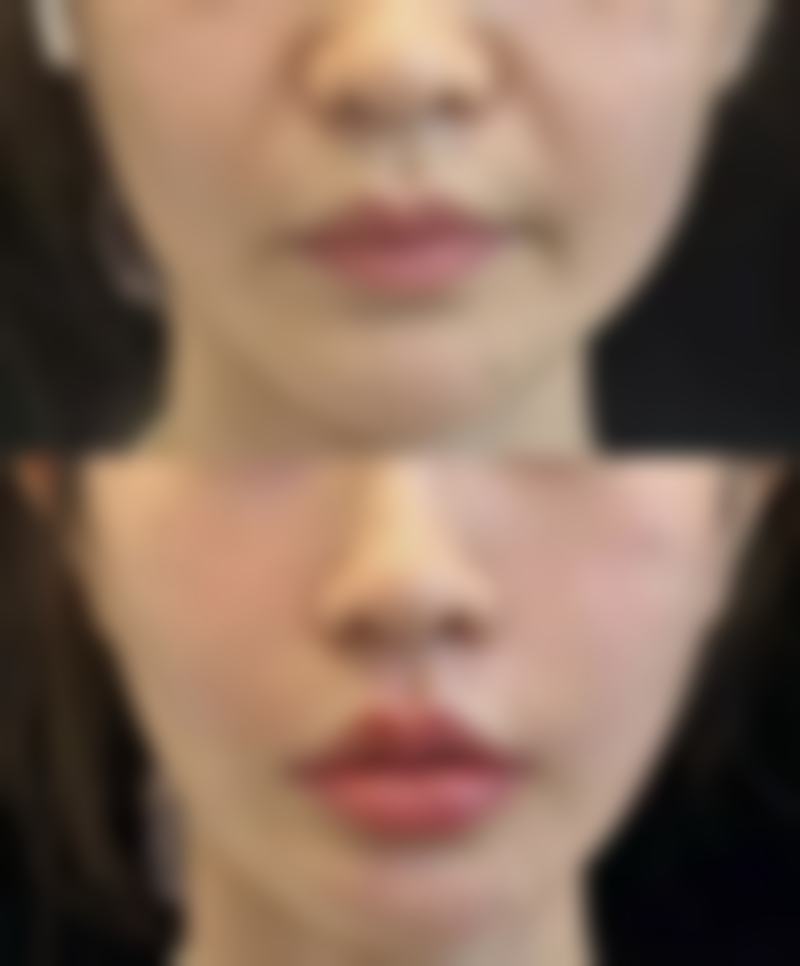 如果尝试多种药膏后成效不佳怎么办？