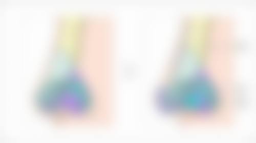 线雕隆鼻线要取吗？揭开美鼻背后的真相与注意事项！哪些情况需取出线体你了解吗？ 