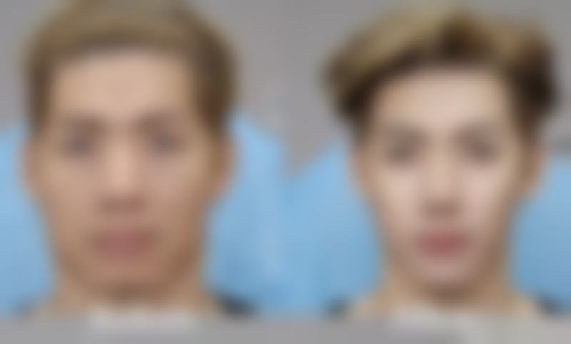 福建省立医院黄雄梅医生乳房整形技术怎么样？