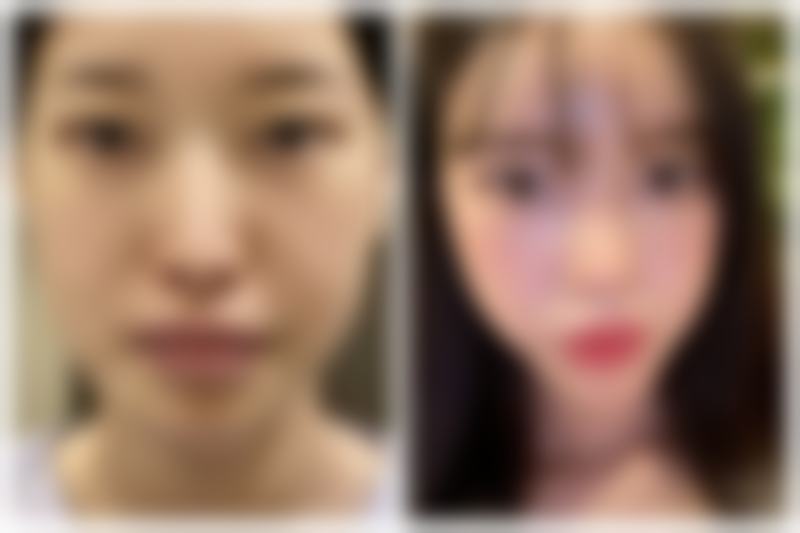 海口段碧辉医疗美容诊所段碧辉医生擅长项目