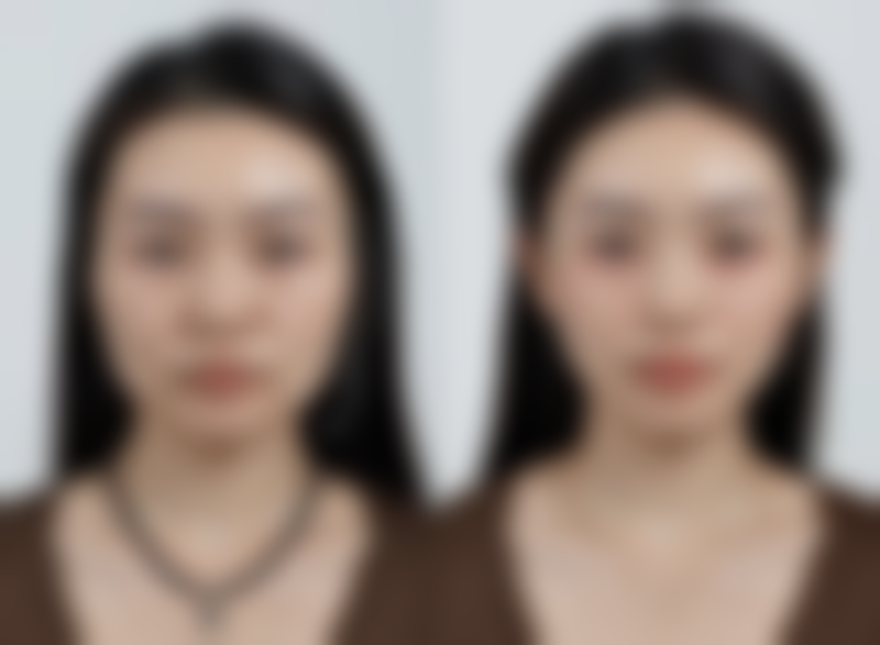 伤口破了怎么不留疤痕？有效护理技巧之特殊群体的注意事项