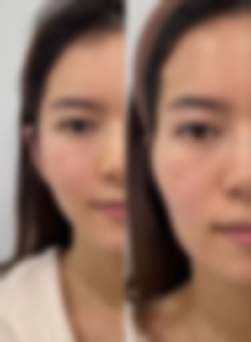 海口段碧辉医疗美容诊所段碧辉医生患者评价