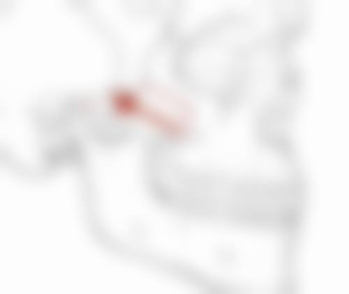 隆胸后有哪些注意事项？