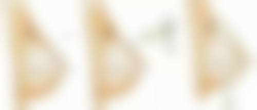 脸上缝针疤痕什么时候进行修复比较好？