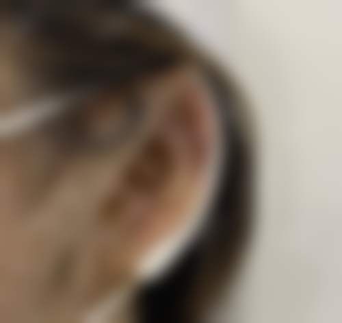 福州艾尚美医疗美容门诊部周镇龙医生面部除皱技术怎么样？