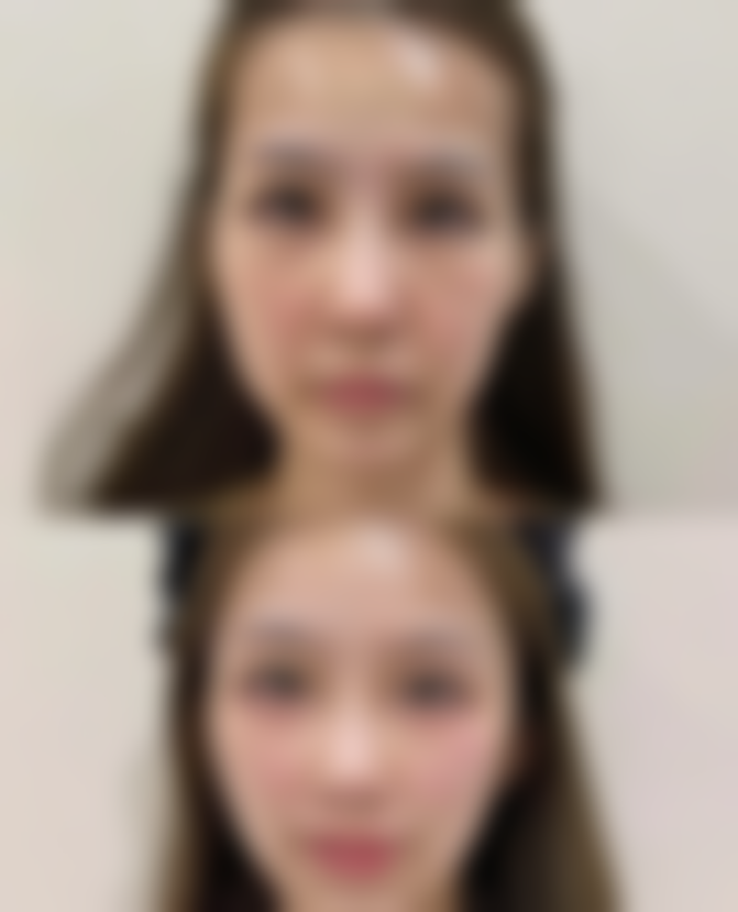 青岛元美整形医疗美容门诊部怎么预约：