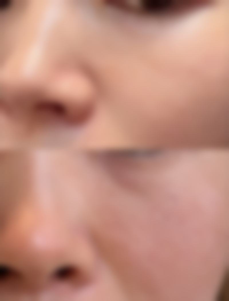 北京金炫澈整形美容医院怎么预约