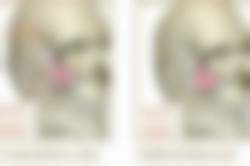 问题二:点阵激光治疗面部凹陷疤痕有什么特点?