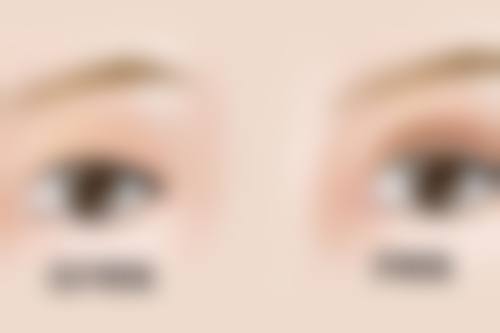 沈阳馨雅医疗美容诊所徐路医生患者评价